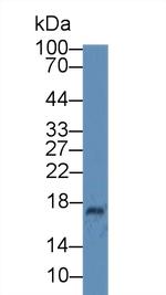 Ceruloplasmin Antibody in Western Blot (WB)