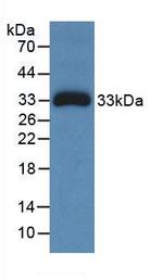 Ceruloplasmin Antibody in Western Blot (WB)