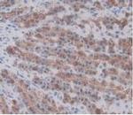 Prothrombin Antibody in Immunohistochemistry (Paraffin) (IHC (P))