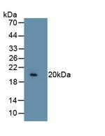 COL8A1 Antibody in Western Blot (WB)