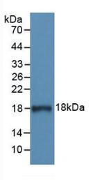 C1 inhibitor Antibody in Western Blot (WB)