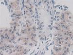 Cyclophilin A Antibody in Immunohistochemistry (Paraffin) (IHC (P))