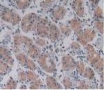 PLA2G4A Antibody in Immunohistochemistry (Paraffin) (IHC (P))