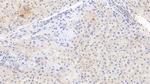 Fibrinogen Beta Chain Antibody in Immunohistochemistry (Paraffin) (IHC (P))