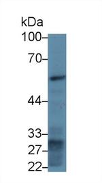 Fibrinogen Beta Chain Antibody in Western Blot (WB)