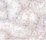 HPR Antibody in Immunohistochemistry (Paraffin) (IHC (P))