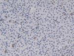 HSP20 Antibody in Immunohistochemistry (Paraffin) (IHC (P))