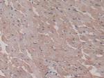 HSP20 Antibody in Immunohistochemistry (Paraffin) (IHC (P))