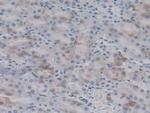 HSP20 Antibody in Immunohistochemistry (Paraffin) (IHC (P))