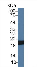 HSP20 Antibody in Western Blot (WB)