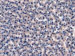 IGFBP4 Antibody in Immunohistochemistry (Paraffin) (IHC (P))