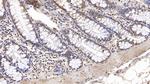 IGFBP4 Antibody in Immunohistochemistry (Paraffin) (IHC (P))