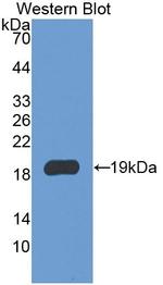 IBA1 Antibody in Western Blot (WB)