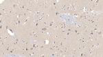 LCAT Antibody in Immunohistochemistry (Paraffin) (IHC (P))