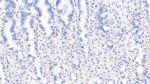 LSR Antibody in Immunohistochemistry (Paraffin) (IHC (P))