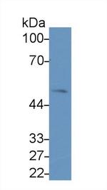 LSR Antibody in Western Blot (WB)