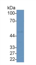 LSR Antibody in Western Blot (WB)