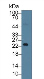 Nephrin Antibody in Western Blot (WB)