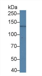 Nephrin Antibody in Western Blot (WB)