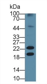 Neurokinin A Antibody in Western Blot (WB)