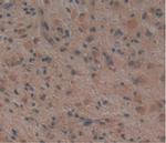 Noggin Antibody in Immunohistochemistry (Paraffin) (IHC (P))