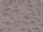 Noggin Antibody in Immunohistochemistry (Paraffin) (IHC (P))