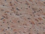 Noggin Antibody in Immunohistochemistry (Paraffin) (IHC (P))