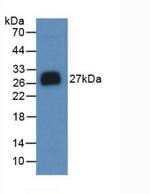 Noggin Antibody in Western Blot (WB)