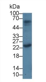 PTHLH Antibody in Western Blot (WB)