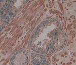 Procollagen I N-Peptide Antibody in Immunohistochemistry (Paraffin) (IHC (P))