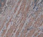 Procollagen I N-Peptide Antibody in Immunohistochemistry (Paraffin) (IHC (P))