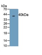 Procollagen I N-Peptide Antibody in Western Blot (WB)