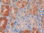 RBP4 Antibody in Immunohistochemistry (Paraffin) (IHC (P))