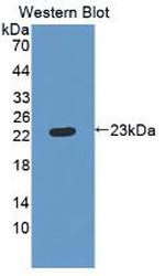 RBP4 Antibody in Western Blot (WB)