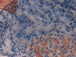 TFF2 Antibody in Immunohistochemistry (Paraffin) (IHC (P))