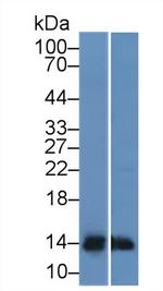 TFF2 Antibody in Western Blot (WB)