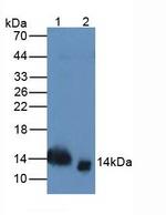 TFF2 Antibody in Western Blot (WB)