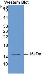 TFF2 Antibody in Western Blot (WB)