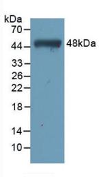 Cardiac Troponin I Antibody in Western Blot (WB)