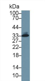 Tryptase Antibody in Western Blot (WB)