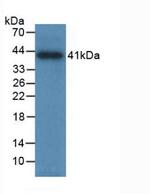 Tryptase Antibody in Western Blot (WB)