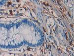 Tryptase Antibody in Immunohistochemistry (Paraffin) (IHC (P))