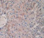 Tryptase Antibody in Immunohistochemistry (Paraffin) (IHC (P))