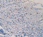 Tryptase Antibody in Immunohistochemistry (Paraffin) (IHC (P))