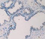 Tryptase Antibody in Immunohistochemistry (Paraffin) (IHC (P))