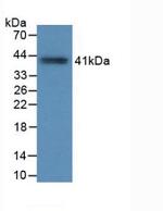 Tryptase Antibody in Western Blot (WB)