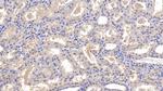 GC Antibody in Immunohistochemistry (Paraffin) (IHC (P))