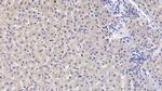 GC Antibody in Immunohistochemistry (Paraffin) (IHC (P))