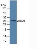 GC Antibody in Western Blot (WB)