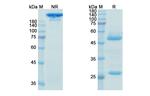 Ocrelizumab Humanized Antibody in SDS-PAGE (SDS-PAGE)